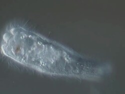 Miracidium stage of Liver Fluke Fasciola hepatica showing cilia. Differential interference contrast horizontal field of view about 160 microns.Eggs supplied by Dr Philip Skuce Stock Footage