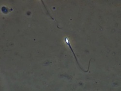 Human sperm swimming Stock Footage