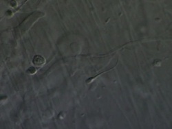 Single Human sperm swimming against the flow of semenal plasma, Interference contrast Stock Footage