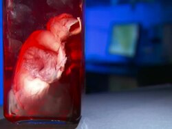 Medium Close Up_static - A glass jar holds a human organ suspended in liquid.   Stock Footage