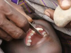 Man cutting boy's tooth during ritual Stock Footage