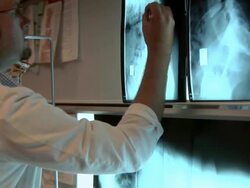 Doctor reviews X-Rays Stock Footage