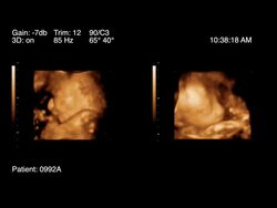 Ultrasound of baby child in womb - 3D Stock Footage