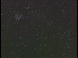 Microscopic, Salmonella typhimureum bacteria Stock Footage