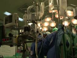 open-heart sergery, doctors around the operated child, in wolfson hospital. Save A Child''s Heart project. Stock Footage