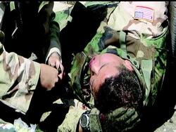 Wisconsin doctor calls attention to long-term effects of  combat trauma after being nearly killed himself News Clip