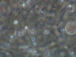 Human sperm race Stock Footage