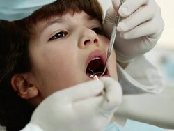 Young girl at the dentist Stock Footage