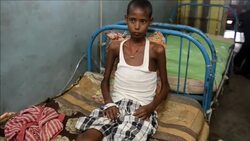 CLEAN : Encephalitis outbreaks in India kill more than 150 News Clip