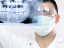 Dentist looking at tooth x-ray. Stock Footage