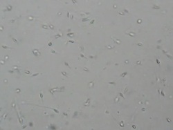 Sperm under microscope 400x Stock Footage