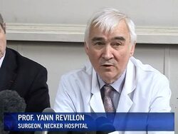 Conjoined twins separated in Paris hospital News Clip