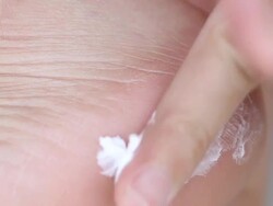 Closeup view of cracks on a heel Stock Footage