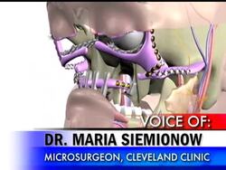 The Cleveland Clinic is holding a limited press briefing with the woman who had a face transplant there. News Clip