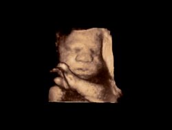 Foetus arm across face up close, rotating 3D ultrasound.. Stock Footage
