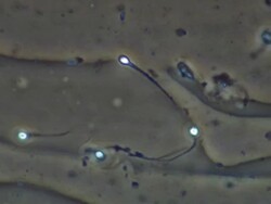 Human sperm, single sperm swimming Stock Footage