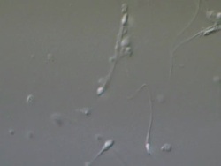 Human sperm swimming, Interference contrast Stock Footage