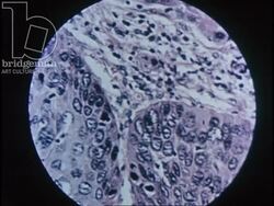 A young lady gets shown the histology department of a hospital laboratory, 1954 Stock Footage