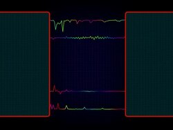 Comparison box - Loopable Stock Footage