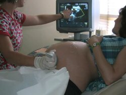 Ultrasound Exam Stock Footage