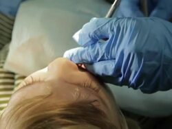 Little Boy In Dental Office Stock Footage