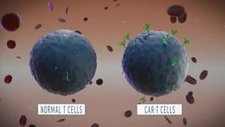 US clears first 'living drug' for tough childhood leukemia ++Animation++ News Clip