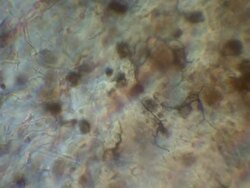 Slow track across Toad tadpole tail capillary network. Olympus BH-2 microscope, Olympus S-Plan 20x objective, NFK 1.67x photoeyepiece. Stock Footage