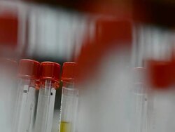 blood tube Stock Footage