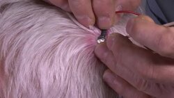 Study uses magnetic stimulation to detect dementia News Clip