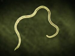 High Angle hand-held - A parasitic worm floats in front of a green background in a computer-generated animation. Stock Footage