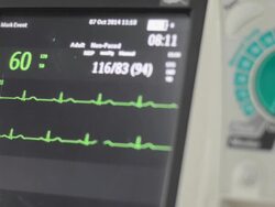 Defibrillator Stock Footage