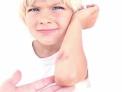 got hurt Stock Footage