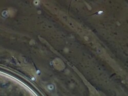 Human sperm, swimming, track with sperm to several sperm at edge of egg-like shere Stock Footage