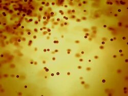 HD Super Slow-Mo: Bubble Background Stock Footage