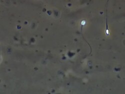 Human sperm, single sperm swimming Stock Footage