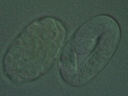 Caenorhabditis elegans eggs at different stages of development. Olympus BH-2 microscope, 60x S-Plan Apochromat objective, NFK 3.3 photoeyepiece, Differential Interference Contrast, horizontal field of view 90 microns. Time Lapse: 1 frame/second Stock Footage