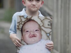 Slow motion rack focus of young boy holding up baby photo of himself with cleft palate. Stock Footage