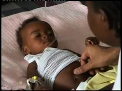 Concerns about health risks as rainy season  begins News Clip