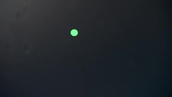 Eye study may detect early stage Alzheimer's News Clip