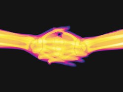 Slow X-ray handshake Stock Footage