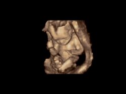 Foetus in the womb, rotating 3D ultrasound scan.. Stock Footage