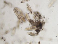 Groupe of 	Paramecium Caudatums Stock Footage