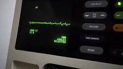 Defibrillator Stock Footage