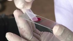 VOICED : Nueva esperanza contra malaria News Clip