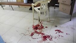 VOICED : Liberan pandillero dejan siete muertos en hospital guatemalteco News Clip