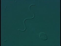 Microscopic view of static Spirochaete bacteria Stock Footage