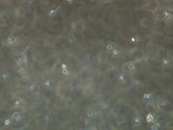 Human sperm swimming, Phase contrast Stock Footage