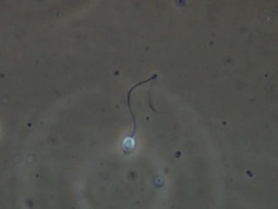 Human sperm, two sperm swimming rather ineffectually Stock Footage