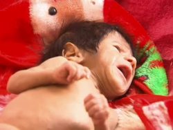 Population Suffering From Severe Malnutrition News Clip