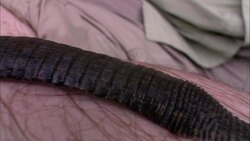 A large leech slithers over a man's arm. Stock Footage